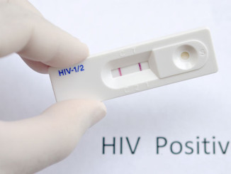 Ansatz für HIV-Impfung - © jarun011 - Fotolia